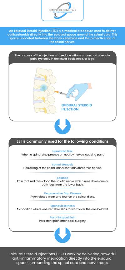 Epidural injections at Comprehensive Pain provide significant relief for those suffering from chronic pain, including back, neck, and leg pain. This minimally invasive procedure delivers anti-inflammatory medication directly to the affected area, reducing pain and inflammation. Our specialists ensure you receive the most effective treatment tailored to your unique needs. For more information, contact us or book an appointment online. Our clinics are conveniently located in Greenacres, FL, and Port St. Lucie, FL. Epidural injections at Comprehensive Pain provide significant relief for those suffering from chronic pain, including back, neck, and leg pain. This minimally invasive procedure delivers anti-inflammatory medication directly to the affected area, reducing pain and inflammation. Our specialists ensure you receive the most effective treatment tailored to your unique needs. For more information, contact us or book an appointment online. Our clinics are conveniently located in Greenacres, FL, and Port St. Lucie, FL.