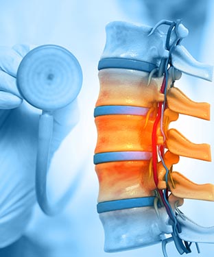 Osteoporosis Treatment Specialist in Greenacres FL and Port St. Lucie FL. Osteoporosis Treatment Specialist in Greenacres FL and Port St. Lucie FL.