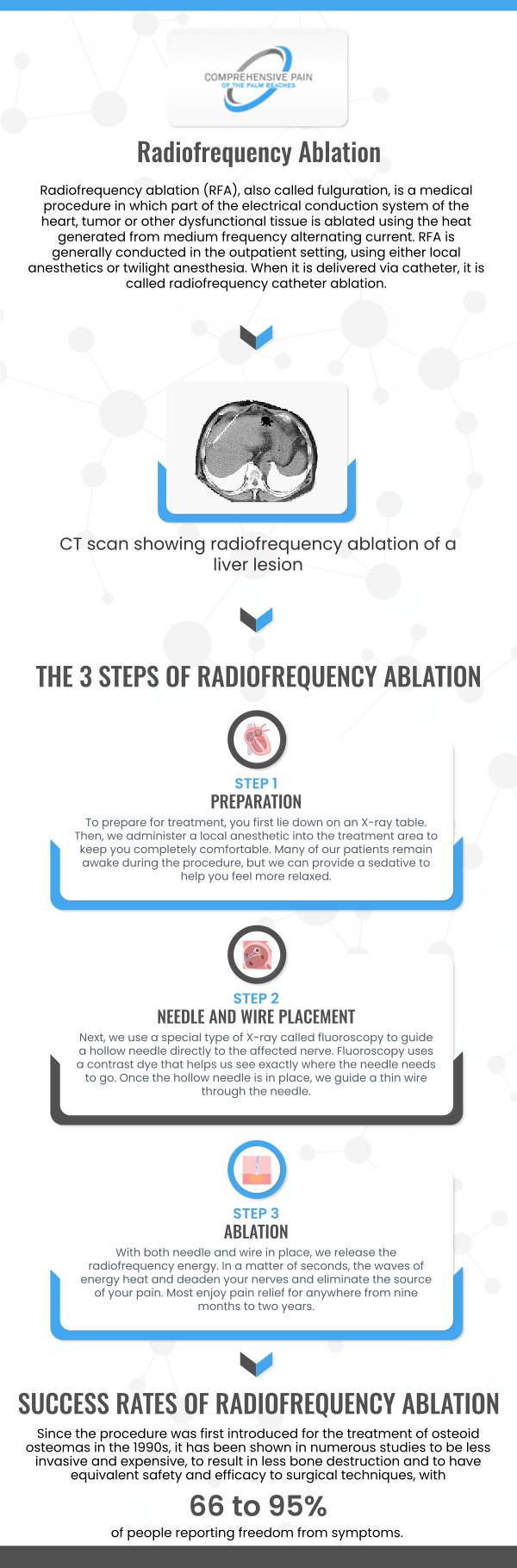 Radiofequency Ablation Treatment Specialist in Greenacres FL and Port St. Lucie FL.