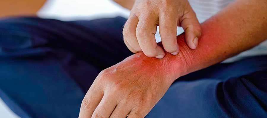 Shingles Pain Treatment Specialist Near Me in Greenacres FL and Port St. Lucie FL