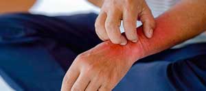 Shingles Pain Treatment Specialist Near Me in Greenacres FL and Port St. Lucie FL