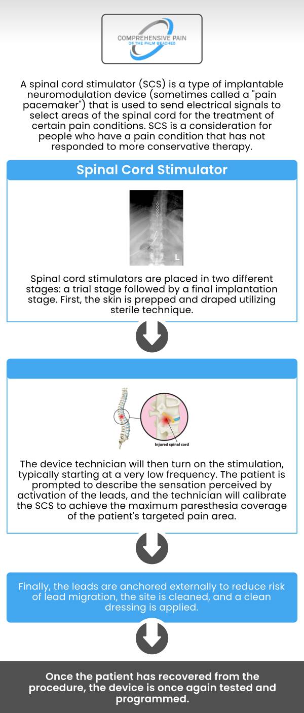 Common questions asked by patients: How to prepare for a spinal cord stimulator trial? How long does a spinal cord stimulator trial procedure take? How much does the spinal cord stimulator trial cost? What is the success rate of the spinal cord stimulator trial? Our medical team at Comprehensive Pain of the Palm Beaches offers a spinal cord stimulator trial procedure. For more information, contact us or book an appointment online. Our clinics are conveniently located in Greenacres, FL, and Port St. Lucie, FL. We serve patients from Port St. Lucie FL, Stuart FL, Palm City FL, Greenacres FL, Palm Springs FL, Boynton Beach FL, and surrounding areas. Common questions asked by patients: How to prepare for a spinal cord stimulator trial? How long does a spinal cord stimulator trial procedure take? How much does the spinal cord stimulator trial cost? What is the success rate of the spinal cord stimulator trial? Our medical team at Comprehensive Pain of the Palm Beaches offers a spinal cord stimulator trial procedure. For more information, contact us or book an appointment online. Our clinics are conveniently located in Greenacres, FL, and Port St. Lucie, FL. We serve patients from Port St. Lucie FL, Stuart FL, Palm City FL, Greenacres FL, Palm Springs FL, Boynton Beach FL, and surrounding areas.