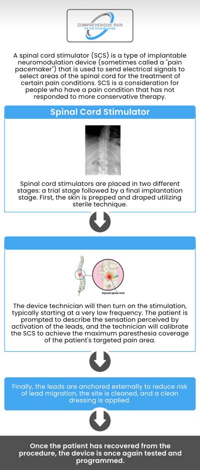 Common questions asked by patients: How to prepare for a spinal cord stimulator trial? How long does a spinal cord stimulator trial procedure take? How much does the spinal cord stimulator trial cost? What is the success rate of the spinal cord stimulator trial? Our medical team at Comprehensive Pain of the Palm Beaches offers a spinal cord stimulator trial procedure. For more information, contact us or book an appointment online. Our clinics are conveniently located in Greenacres, FL, and Port St. Lucie, FL. We serve patients from Port St. Lucie FL, Stuart FL, Palm City FL, Greenacres FL, Palm Springs FL, Boynton Beach FL, and surrounding areas. Common questions asked by patients: How to prepare for a spinal cord stimulator trial? How long does a spinal cord stimulator trial procedure take? How much does the spinal cord stimulator trial cost? What is the success rate of the spinal cord stimulator trial? Our medical team at Comprehensive Pain of the Palm Beaches offers a spinal cord stimulator trial procedure. For more information, contact us or book an appointment online. Our clinics are conveniently located in Greenacres, FL, and Port St. Lucie, FL. We serve patients from Port St. Lucie FL, Stuart FL, Palm City FL, Greenacres FL, Palm Springs FL, Boynton Beach FL, and surrounding areas.