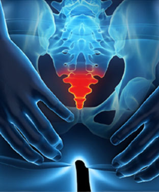 Tailbone Pain Treatment Specialist in Greenacres FL and Port St. Lucie FL. Tailbone Pain Treatment Specialist in Greenacres FL and Port St. Lucie FL.
